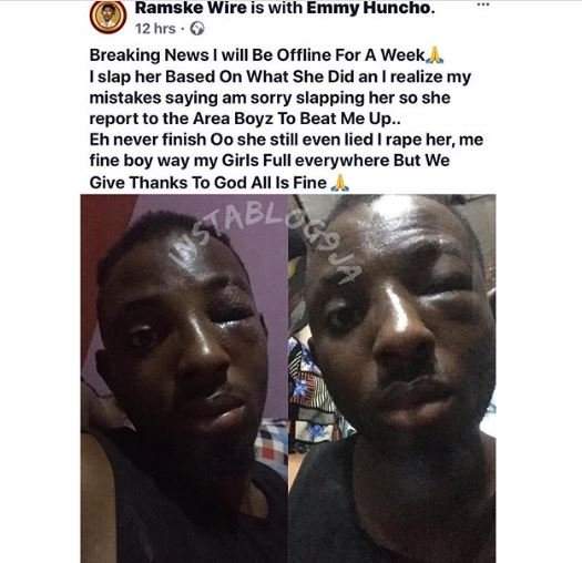THIS WILL SHOCK YOU!! Nigerian Man Recounts What His Lady Did To Him After Giving Her A Slap (Photo)
