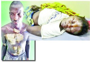 Tragedy as Man Sets Himself Ablaze After Killing Wife He Inherited from His Late Brother