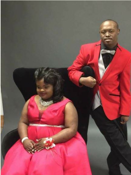 So Touching: Check Out Pre-Wedding Photos Of Couple With Down Syndrome