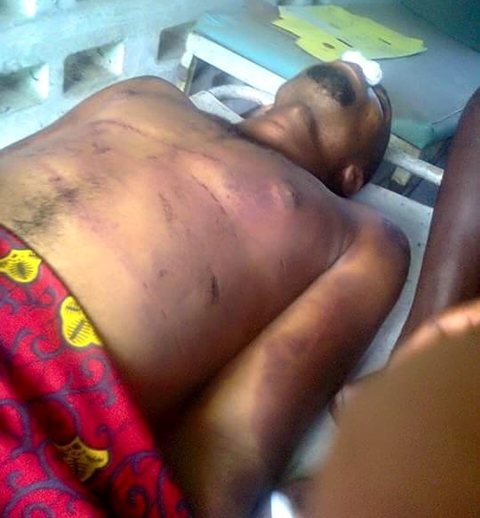 Jungle Justice: Young Man Allegedly Beaten To Death Over Stolen Rods In Rivers State (Photos)