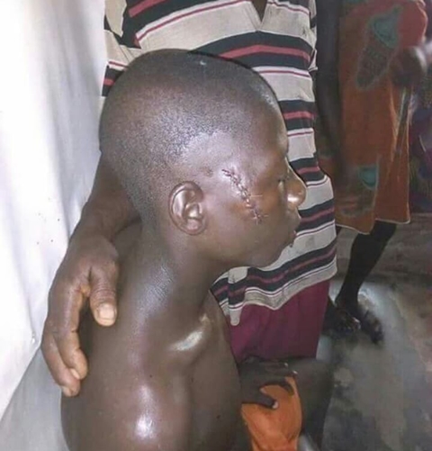 15-year-old Girl Cuts Open A Boy Face During Misunderstanding In Bayelsa (Photos)