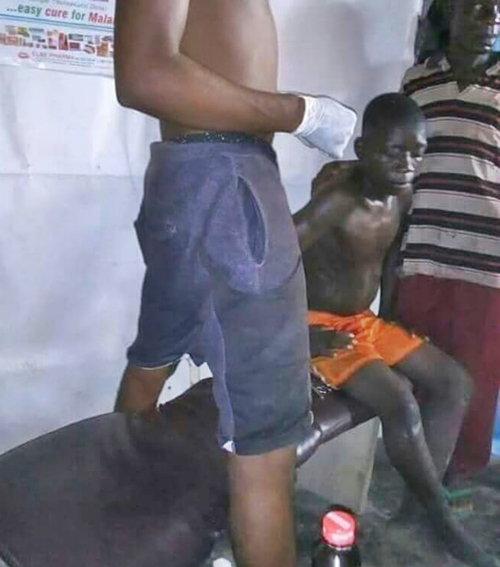 15-year-old Girl Cuts Open A Boy Face During Misunderstanding In Bayelsa (Photos)