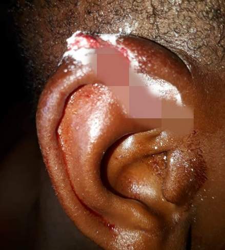 Wicked Father Brutalizes And Cuts His Son's Ear With Razor For Being 'Too Stubborn' (Photos)