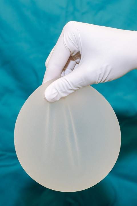 Silicone Breast Implants Increase Arthritis, Stillbirth And Skin Cancer Risk - Study