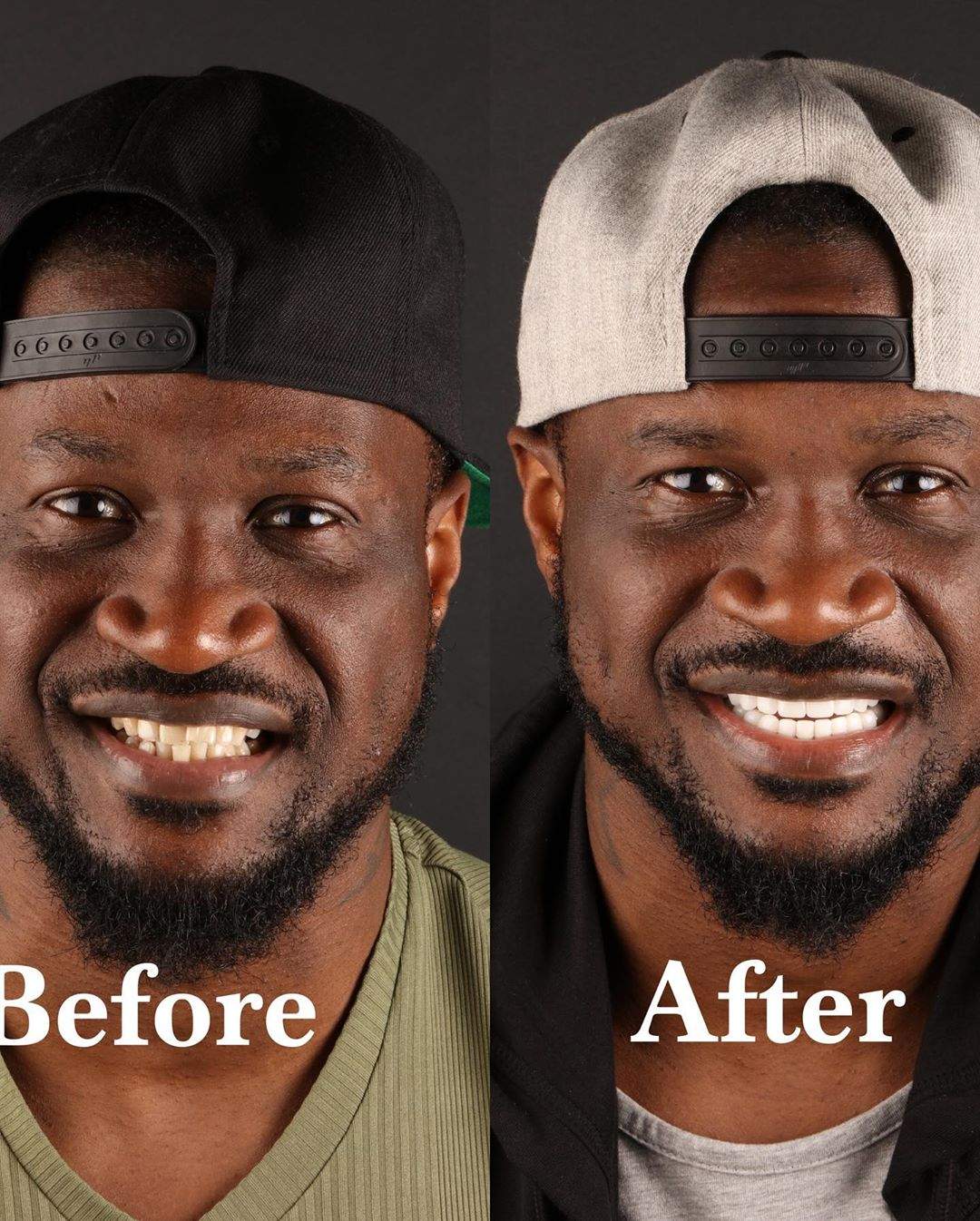 Peter Okoye apologizes to ladies he has kissed after fixing his teeth and undergoing teeth whitening