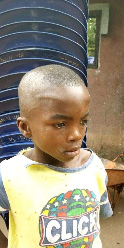 Boy battered by his uncle in Imo State. (Photos)