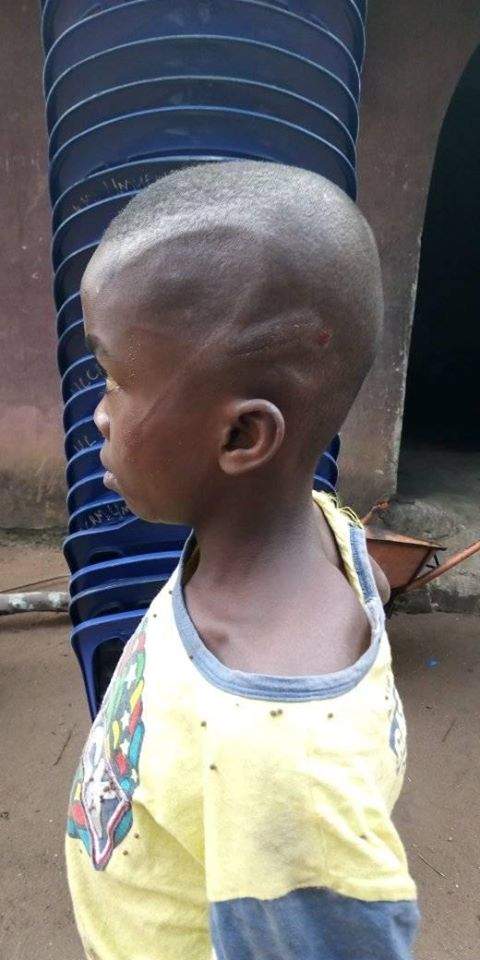 Boy battered by his uncle in Imo State. (Photos)