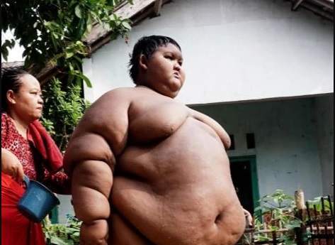 World's fattest boy shows off incredible body transformation after losing more than 30 stone (Photos)