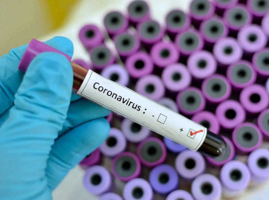 Doctor treating COVID-19 patients in Edo tests positive