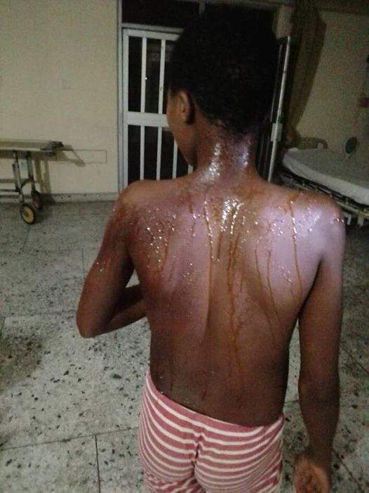 Female police officer accused of dousing 13-year-year-old niece with hot water in Rivers state (Photos)