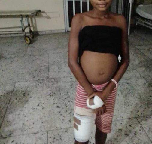 Female police officer accused of dousing 13-year-year-old niece with hot water in Rivers state (Photos)