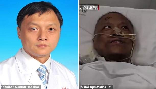 Wuhan doctors who were critically ill with COVID-19 wake up to find that their skin has turned dark after the virus damaged their livers