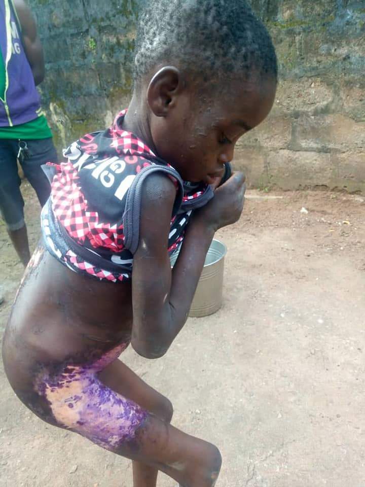 Woman pours hot water on 8-year-old house help for licking milk