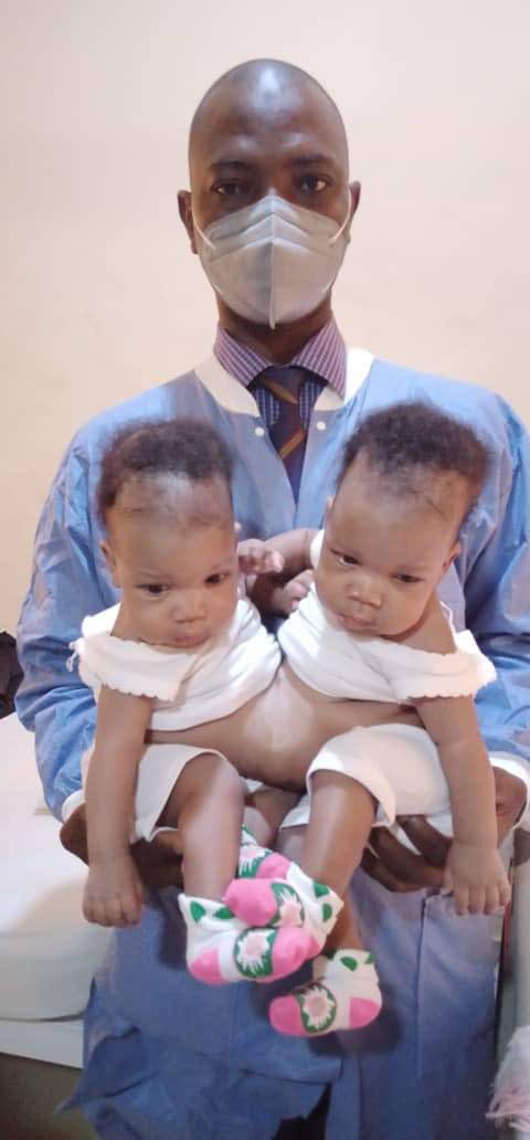 Conjoined female twins separated at the University of Ilorin Teaching Hospital (Photos)