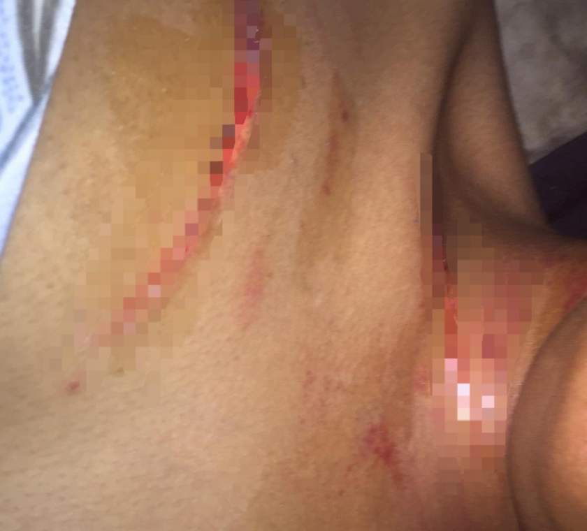 'Please help me' - Video vixen accuses her boyfriend of domestic violence with photo evidence