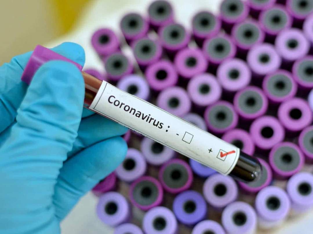 COVID-19: Coronavirus hits 46 countries in Africa, kills 109 people