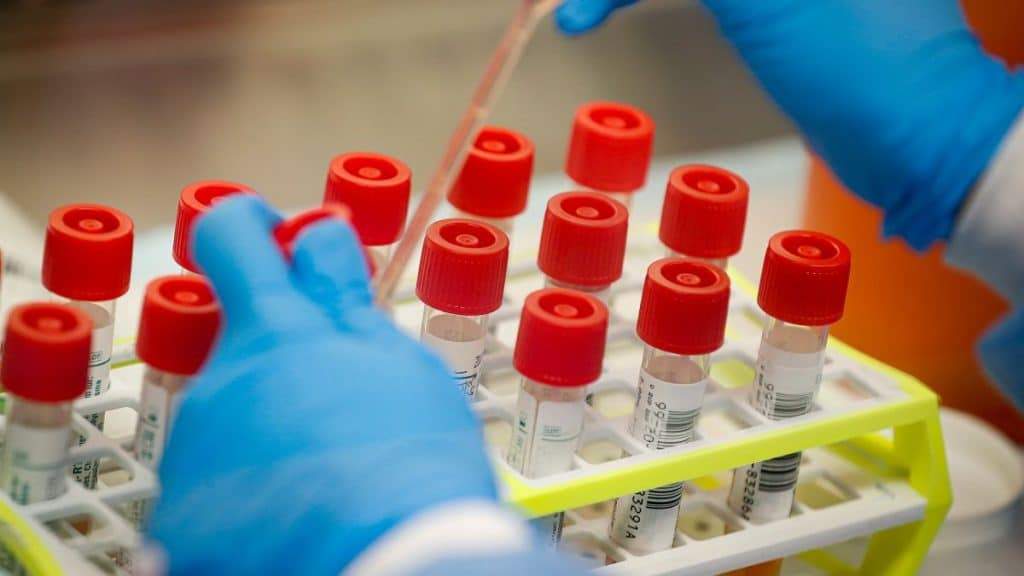COVID-19: British scientist reveals when vaccine for Coronavirus could be ready