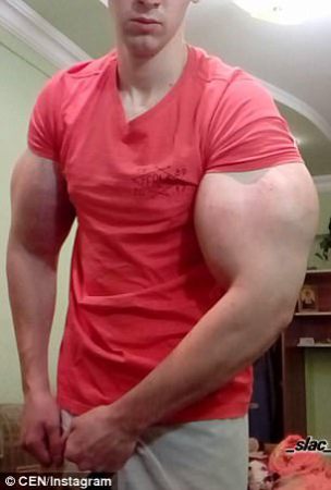 Photos: Russian Man Shows Off His 24inch Biceps After Injecting His Muscles With Dangerous Chemicals