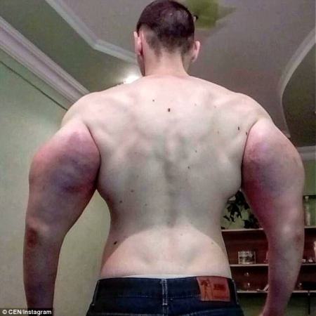 Photos: Russian Man Shows Off His 24inch Biceps After Injecting His Muscles With Dangerous Chemicals