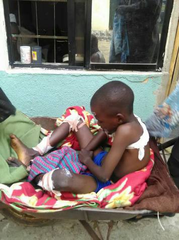 Nigerian Man Takes Son To The Hospital In A Wheelbarrow In Imo State (Photos)