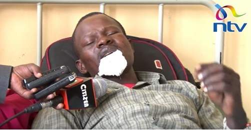 Kenyan woman bites off husband's lip during fight