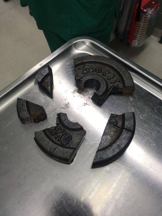 Man Gets His P-enis Stuck In A Gym Weight Plate (Photo)