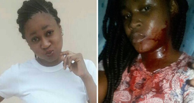 Photos: NOUN Student Hospitalized After Being Stabbed On The Face By Her Hostel Mate In Ibadan.