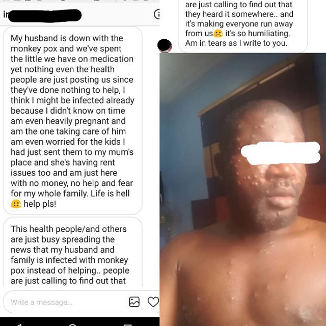 Heavily pregnant Nigerian lady and husband infected with MonkeyPox in Rivers cries out