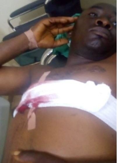Kogi State Police command summons Dino Melaye after his guards allegedly shot a sergeant (Photos)