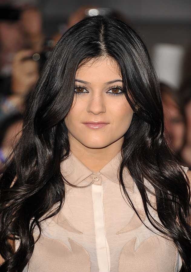 Before and After pictures - Kylie Jenner plastic surgery history