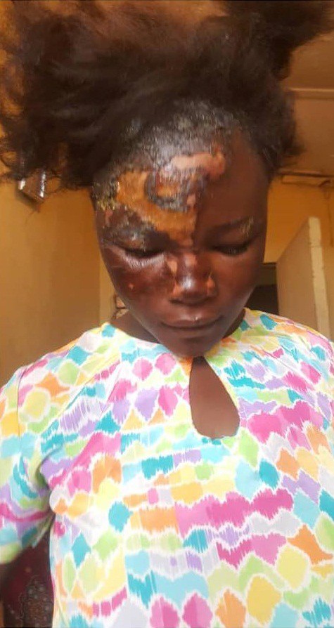 Lady scalds maid with hot water for 'stealing' eggs . (Photo)