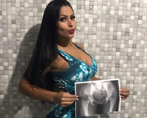 Brazil's Miss bumbum contestants pose with X-rays of their butts to prove they are real