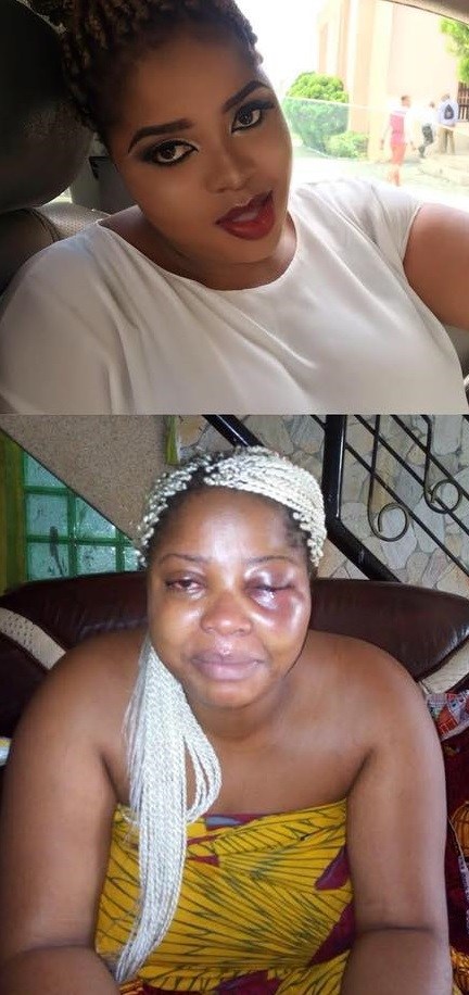 Duncan Mighty beats wife to a pulp (photos)