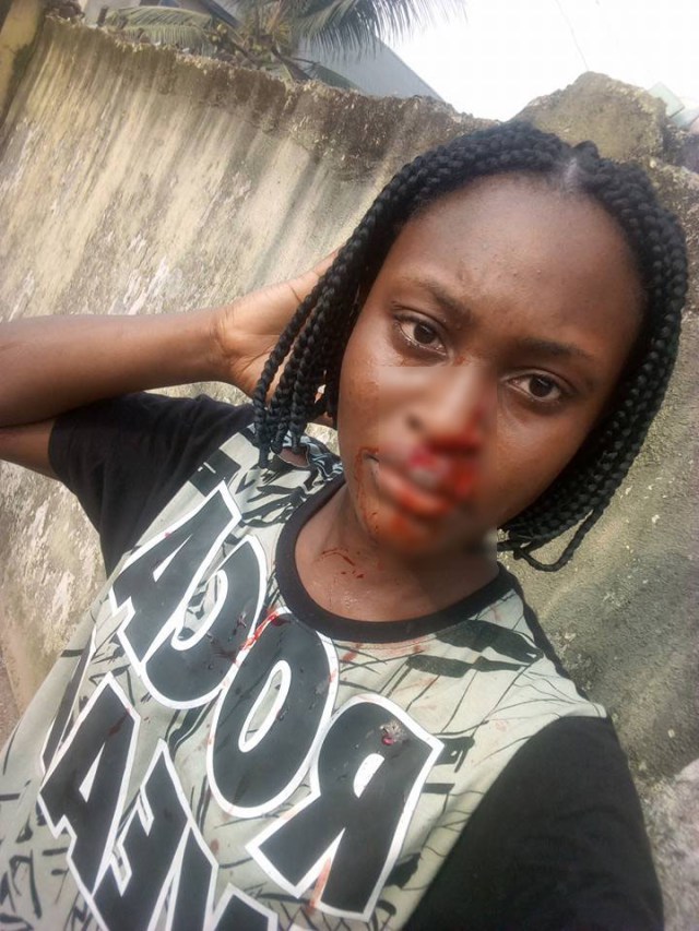 'My roommate cut me with razor because I'm more beautiful than her' - Nigerian Lady (photos)