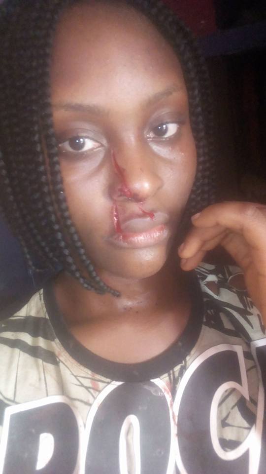 'My roommate cut me with razor because I'm more beautiful than her' - Nigerian Lady (photos)