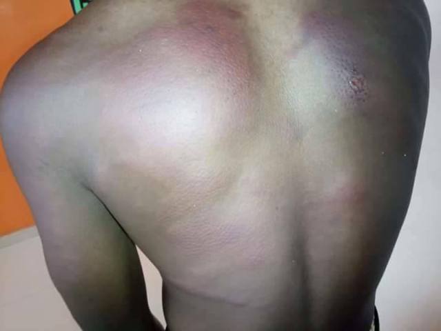 Student beaten mercilessly by his teacher for leaving his hair bushy (photos)