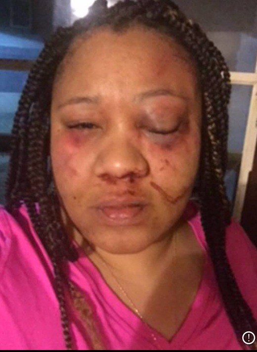 Lady who was almost beaten to death by her fiancé, shares her heartbreaking story.
