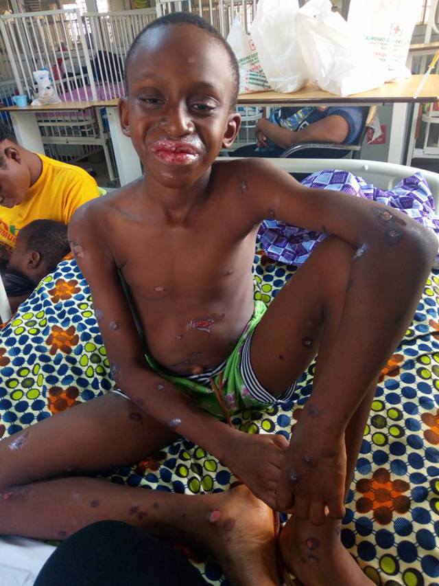 Nigerian boy almost dies after consuming juice (photos)