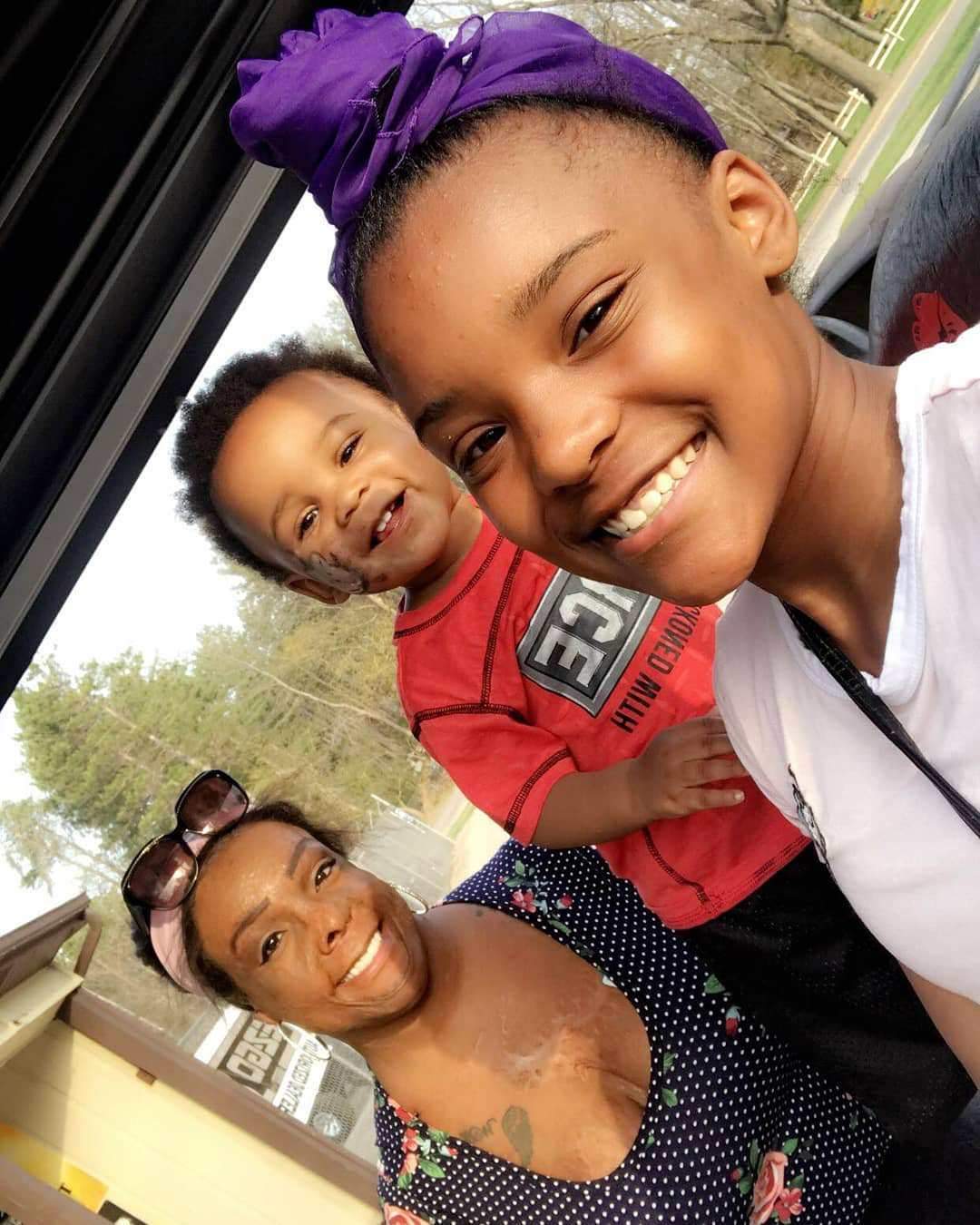 Lovely photos of burn survivor and her two kids melt hearts on social media (Photos)