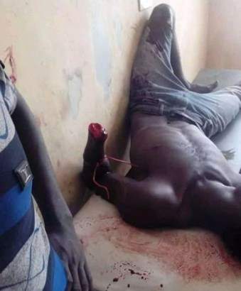 Man chops off his brother's hand on Christmas day in Bayelsa (Graphic Photo)