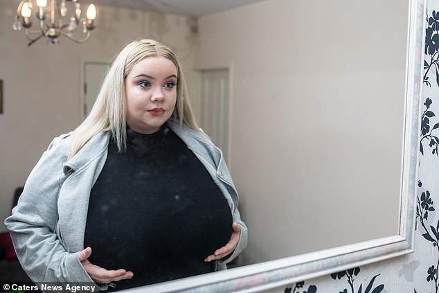 Meet 25-year-old lady with gigantic breasts that won't stop growing due to a rare condition (Photos)