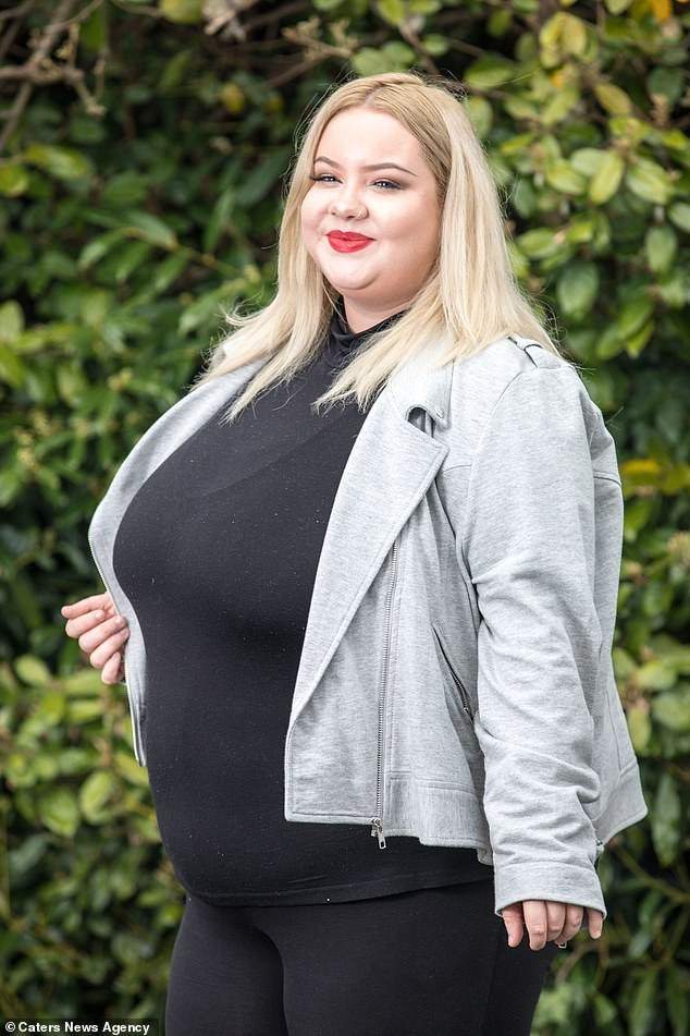 Meet 25 Year Old Lady With Gigantic Breasts That Wont Stop Growing Due To A Rare Condition 