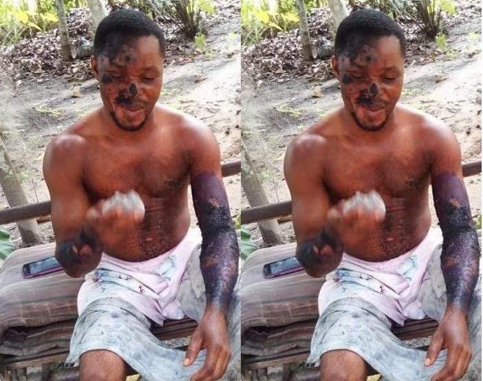 Jealous girlfriend scalds her boyfriend with hot water (Photo)