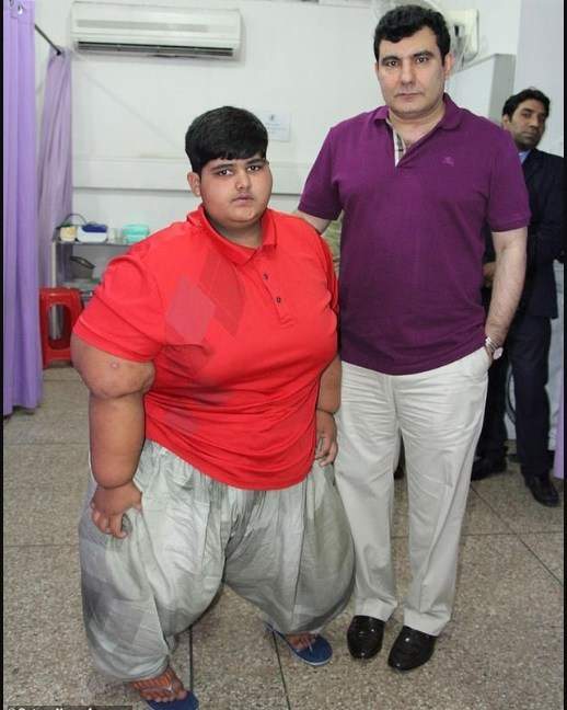 World's Fattest Child Set To Undergo Surgery. (Photos)