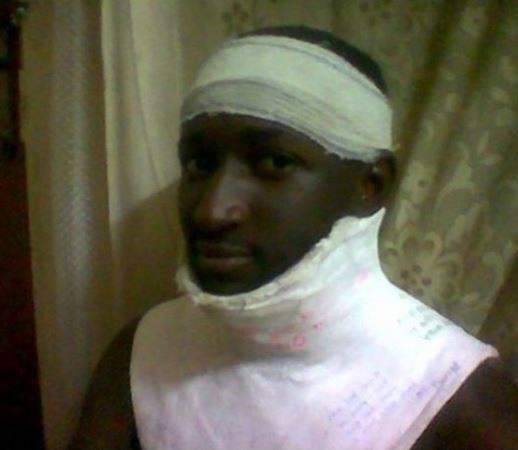 First ever winner of #BBNaija, Katung Aduwak shares photos from a ghastly car crash he survived 15-years ago.