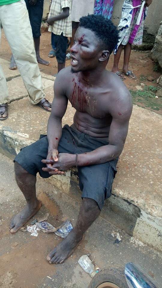 Man's face rearranged after he was found hiding in the ceiling of someone's apartment in Ikorodu (photos)