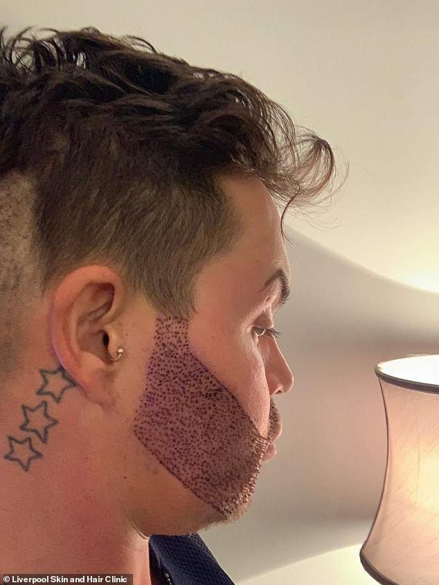 TV personality, Bobby Norris who spent £9,000 on beard transplant, shows off result (Photos)