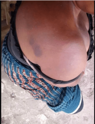 Traditional Ruler allegedly assaults woman over palm fruits in Abia
