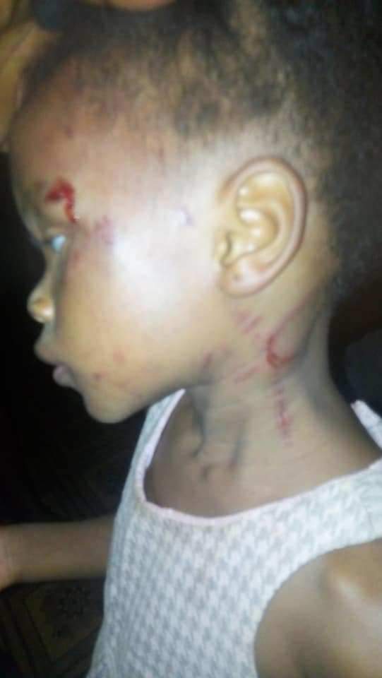 2-year-old girl brutalized for not being about to count 1 to 200 in Ondo State
