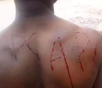 Man bleeds after tattooing APC into his skin to celebrate President Buhari's re-election